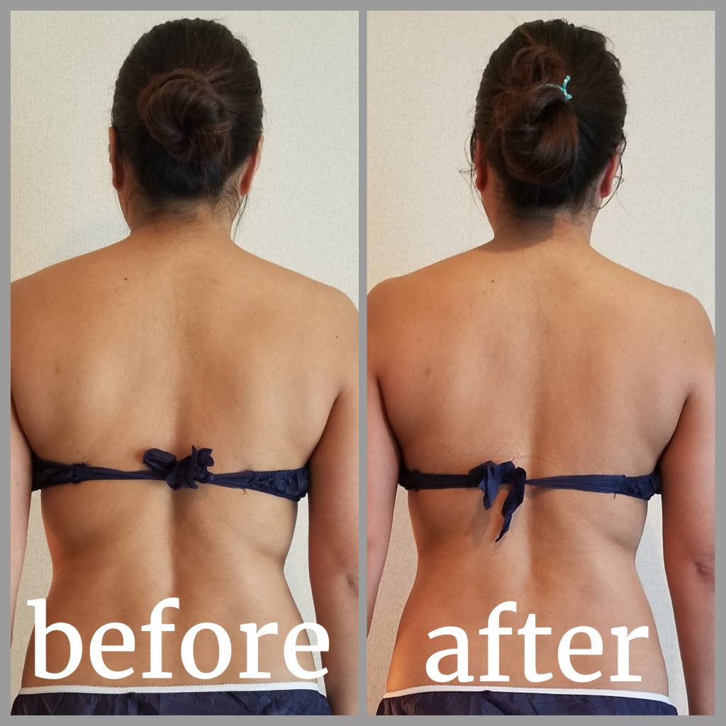 姿勢改善 痩身 オイルマッサージ